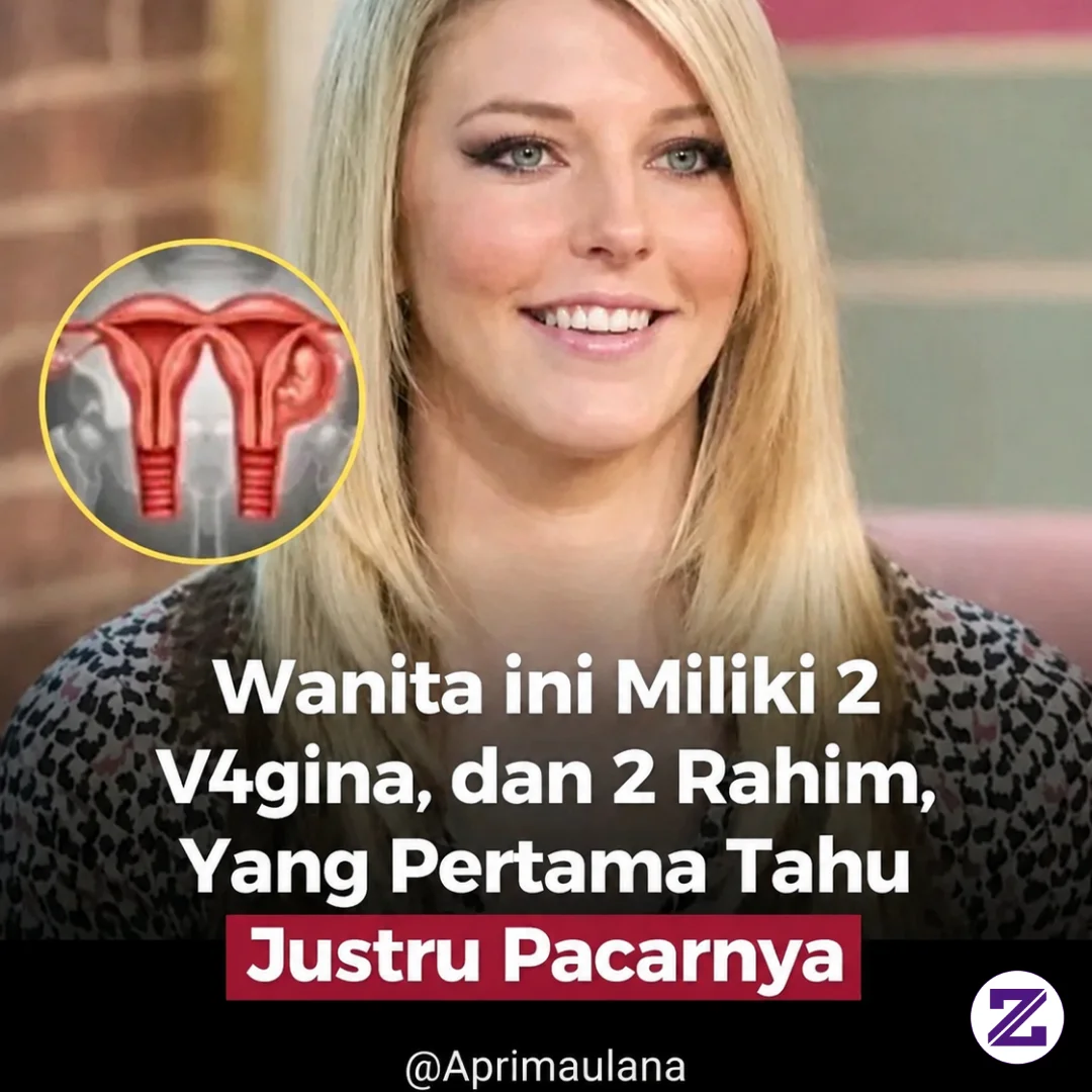 Satu Dari Sejuta Wanita Di Dunia, Lahir Dengan Kondisi Medis Yang Sangat Langka,