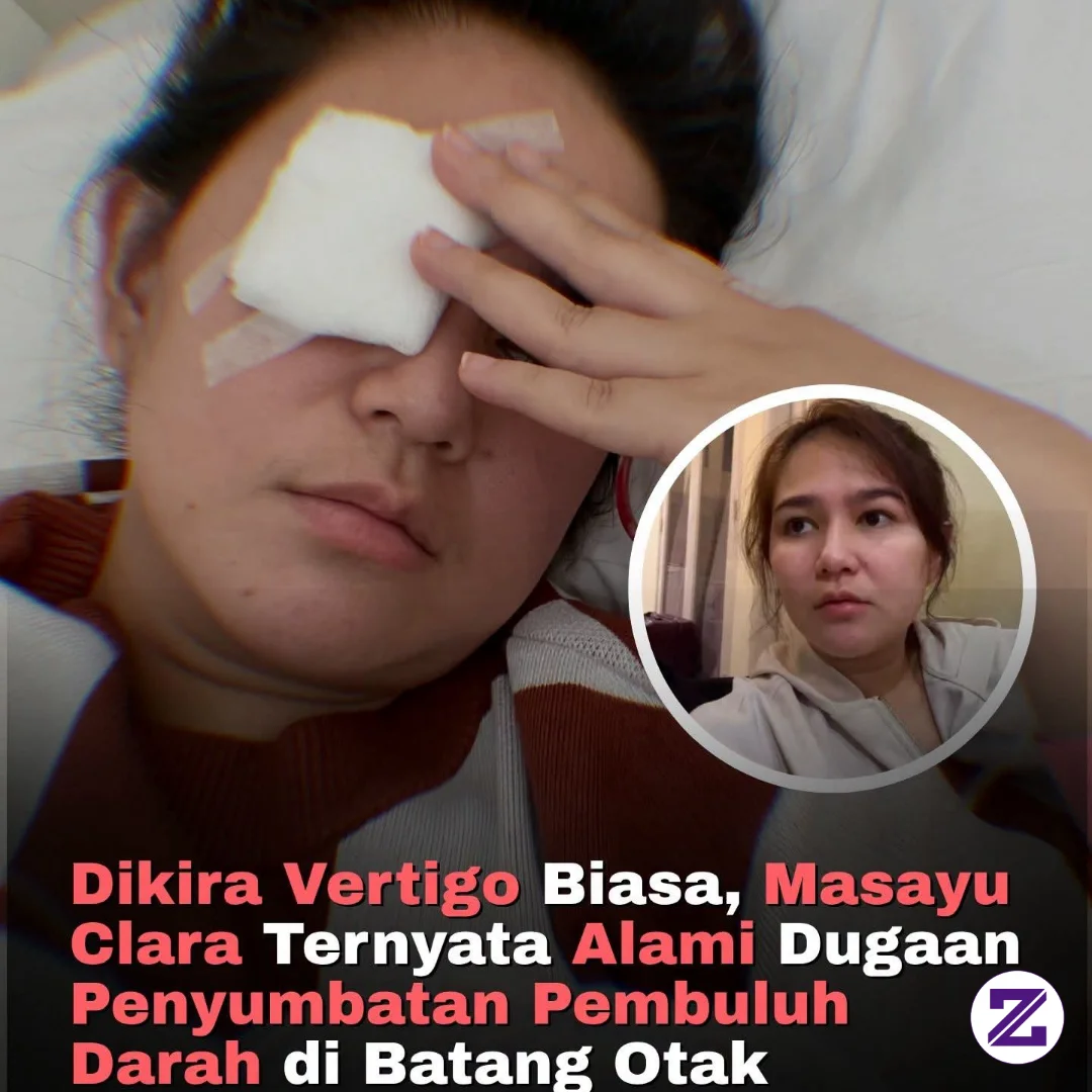 Kabar Kurang Menyenangkan Datang Dari Aktris Masayu Clara. Ia Harus Menjalani