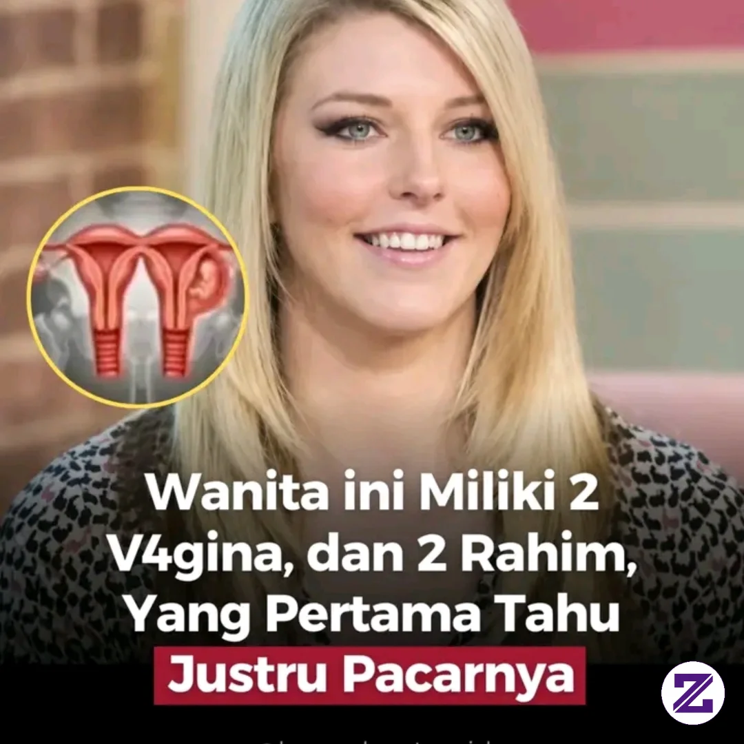 Satu Dari Sejuta Wanita Di Dunia, Lahir Dengan Kondisi Medis Yang Sangat Langka,