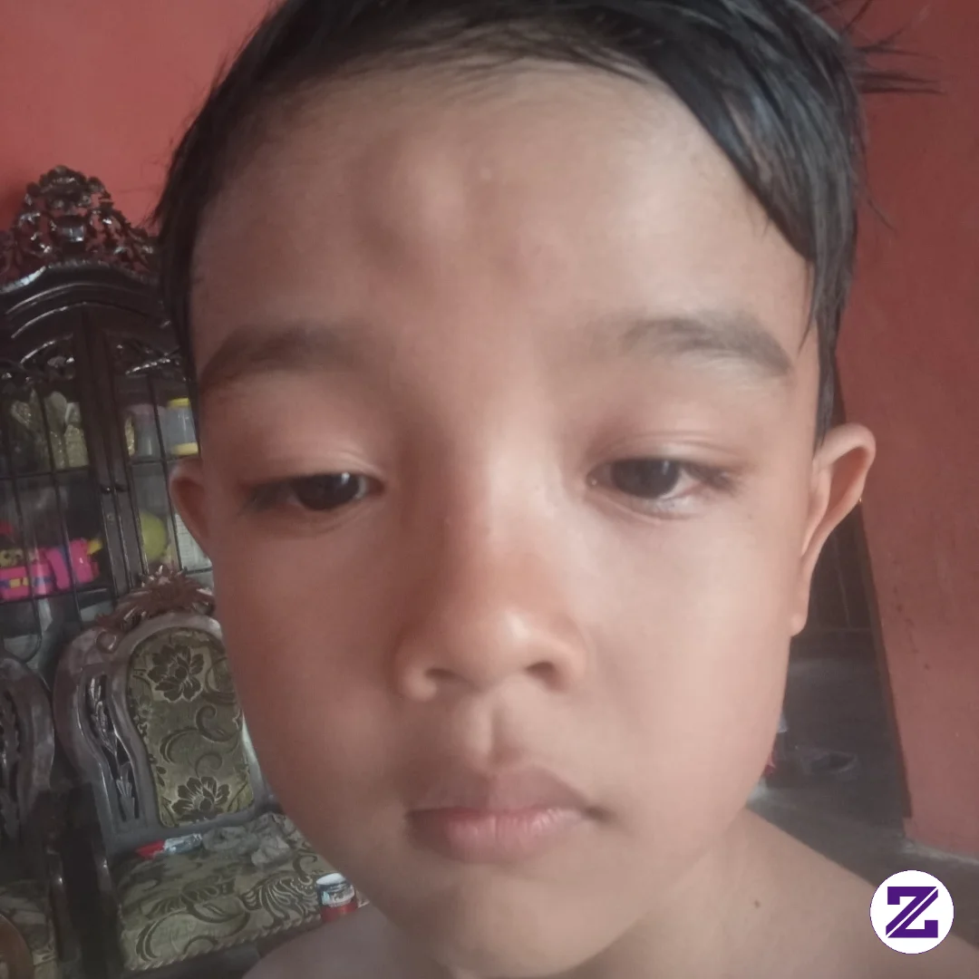 Akibat Di Tonjok Teman Sampai Bendol🤣 Perlunya Membimbing Anak Di Usia Dini